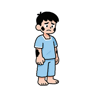 南京胎记医院排名：男人右手臂有胎记全图解科普